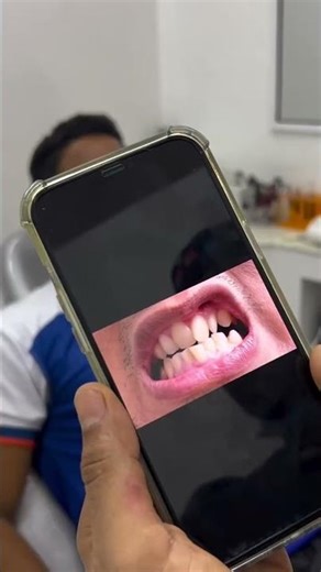 #dentistry #humor #dentist