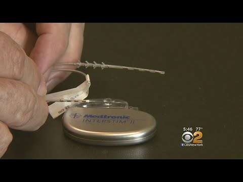 Pacemaker-Like Device Helps Treat Overactive Bladder