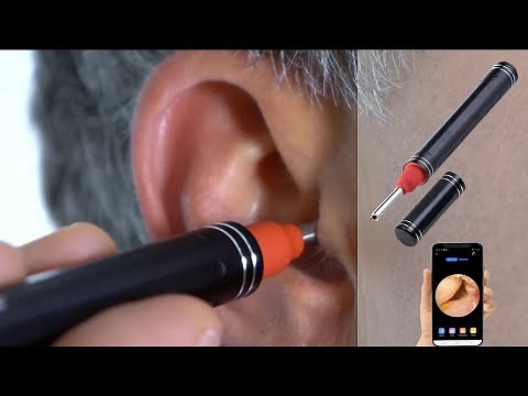 Newgen Medicals OTOSCOPE Connected Ear Cleaner with Full HD Camera [PEARLTV.FR]