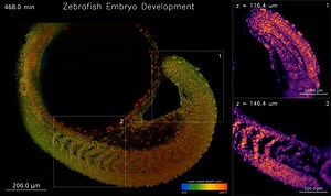 Zebrafish embryo development acquired on the DaXi light-sheet microscope
