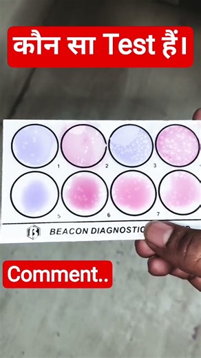 comment...the test name Widal test blood group biology #ytshorts #ytviral #shots #yt