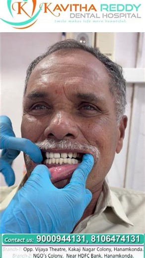 Root Canal Treatment & Dental Cap – Before & After | Kavitha Reddy Dental Hospital, Hanamkonda 1