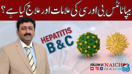 Discover the key symptoms, causes, and effective treatment options for Hepatitis B and Hepatitis C in this informative video by Naich Gi Liver. Learn how these viral infections affect the liver, the early warning signs you should never ignore, and the latest medical treatments available for better recovery. This video also explains prevention tips, testing methods, and when to seek medical help. Watch till the end to protect your liver health and stay informed with trusted medical guidance. #hep