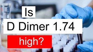 Is D Dimer 1.74 high, normal or dangerous? What does D Dimer level 1.74 mean?