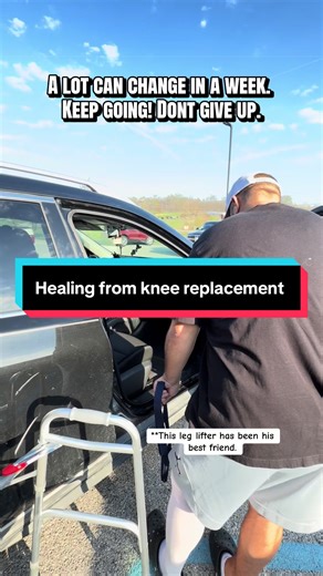 Total Knee Replacement: 1 Week Healing Progress
