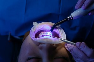 Understanding Comprehensive Dental Insurance Benefits