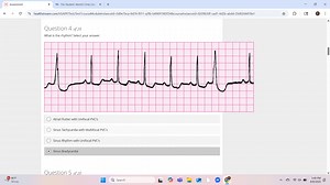 What is the rhythm? Select your answer.[Image of an ECG graph... | Filo