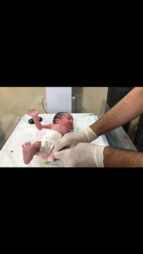 Critical First Assessment in NICU ⚠️ | New Baby RBS Check & Reflex Testing #babygirl #viral #nicunurse #baby | Anoop Gautam