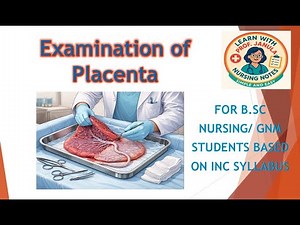 Placenta examination Procedure I #nursingstudents #postpartumrecovery