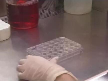 Transwell检测细胞迁移实验技巧（1）