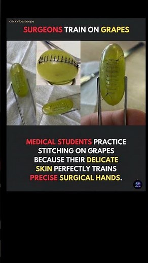 Why do surgeons do surgery on a grape? 🍇💉 The secret behind those steady surgical hands!