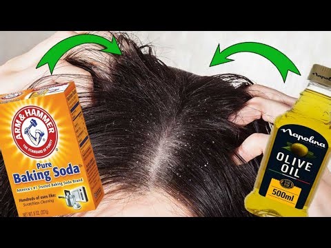 How to Get Rid of Dry Scalp and Dandruff at Home | NATURAL CURES