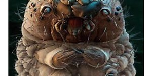 The Creatures Living on Our Skin | Health And Medicine