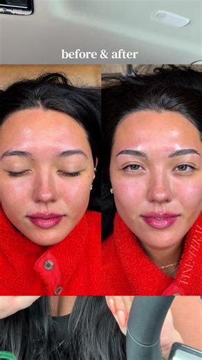 Getting My Eyebrows Nanobladed: Before & After