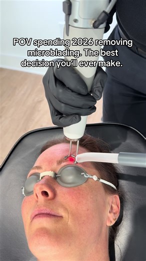 Austin, Texas…. Lets goooo! #microbladingremoval #laserbrows | brows