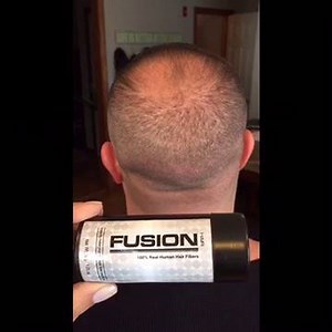 !!! Best Seller Kit (30gm Hair Fiber Hair Fiber Hold Spray Hairline Optimizer) Best Buy: ~ www.realhairfusion.com (35% Off Coupon Code "10K") Offer Price : $49.99 🌎 Worldwide Shipping Available 🌎 INDIA (INR --750) WHATS APP 91-81688-86589 UK (POUND -- 35) WHATS APP 44 7900922650 | Real Hair Fusion