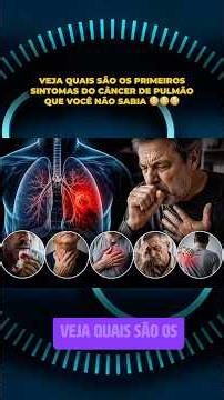 Lung cancer is a malignant tumor that arises