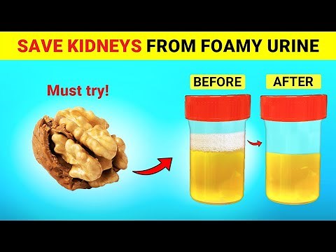 Top 6 Super Foods To Help Stop Proteinuria and Heal Your Kidneys