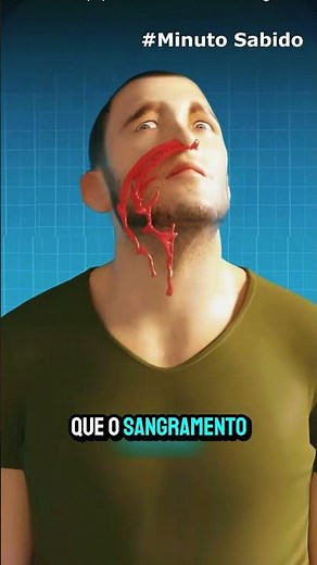 Why Does Your Nose Bleed Suddenly? 99% Do It Wrong to Stop It.