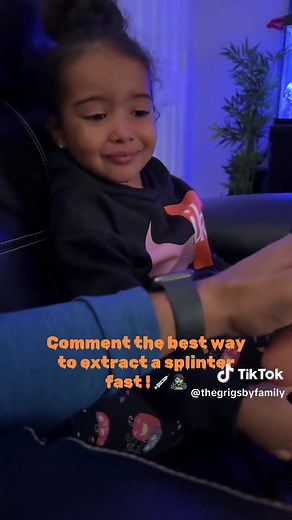 How to Remove Splinters Quickly and Painlessly