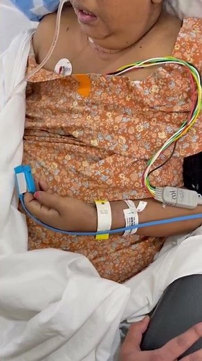 Paradoxical or Seesaw Respiration