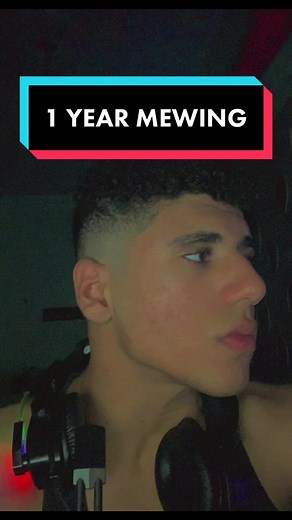 1 Year Mewing Transformation | Jawline Enhancement Results