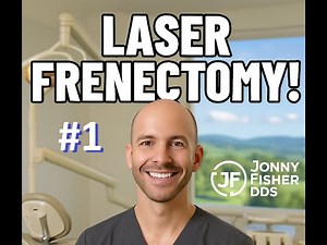 Laser Frenectomy! (Upper Lip)