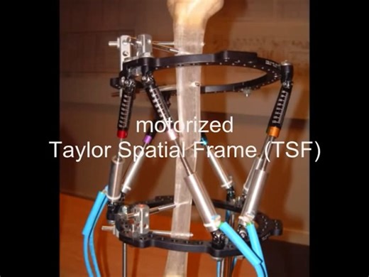 Taylor Spatial Frame驱动