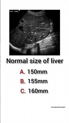 Normal size of liver? #ultrasound#liver#sonography#sonologist#radiology