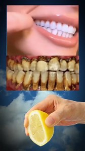 Achieve a Brighter Smile with These Teeth Whitening Tips! 🌟 "Unlock the secret to a radiant smile with our top teeth whitening tips! 😁✨ In this video, we’ll share natural and effective methods to whiten your teeth at home. From easy DIY remedies to essential dental hygiene practices, discover how to maintain a bright, healthy smile. Say goodbye to stains and hello to confidence! 🌿🦷 Don’t forget to like, comment, and share your results! #TeethWhitening #SmileBright #DentalCare #BeautyTips" | 