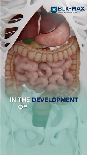 Colorectal Cancer in the Young: What You Need to Know