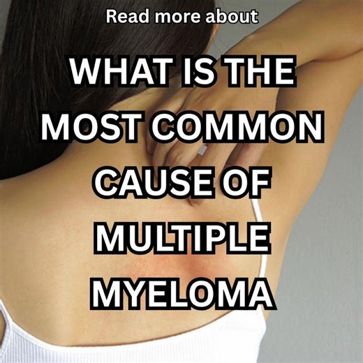 Multiple Myeloma: Symptoms, Diagnosis, and General Information | Total Wellness | Facebook