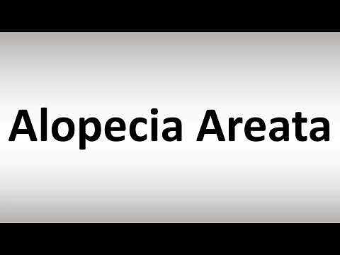 How to Pronounce Alopecia Areata