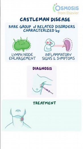 Castleman Disease