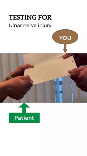 neuro on Instagram: "Froment sign is a classic clinical test for ulnar nerve palsy, especially weakness of the adductor pollicis muscle. 🔹 What is Froment Sign? It assesses the ulnar nerve (C8–T1) function at the hand. 🔹 How to Perform the Test 1. Ask the patient to hold a piece of paper between the thumb and index finger. 2. Try to pull the paper away. 3. Observe how the patient maintains grip. --- 🔹 Positive Froment Sign ✅ The patient flexes the thumb’s interphalangeal (IP) joint to hold th