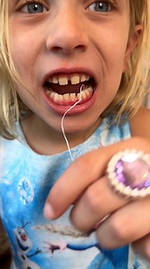 118K views · 746 reactions | Tooth pull by jumping off balcony 﫣 | Flomazing Videos | Facebook