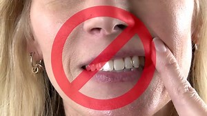 Watch Xylimelts - Oral adhering discs for dry mouth on Amazon Live
