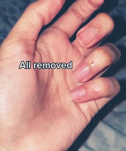 remove acrylic nails at home in 5mins