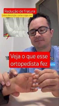 Finger Fracture: Symptoms and Treatment #orthopedics #viralvideos #healthtips #shorts