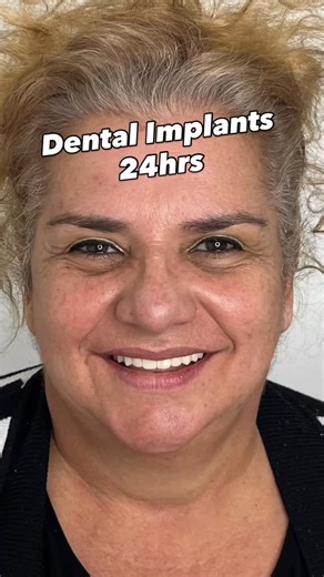 Dr.Implant -Miami/Pembroke Pines/Delray Beach on Instagram: "Transforming Lives in 24hrs.. Free Consultation + 3D Scan + Zirconia Lifetime Warranty #zirconia #smile #wellness #miami #pembrokepines #delraybeach #qualityoflife #calidaddevida #24hrs #smile #implants"