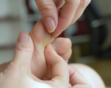 I Have Something Stuck In My Foot | Dr. Lance Silverman