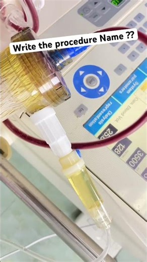 Write answer will be pinned #dialysis #nephrology #plasmapheresis #dialysistechnician #doctor