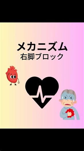 右脚ブロックのメカニズム解説！