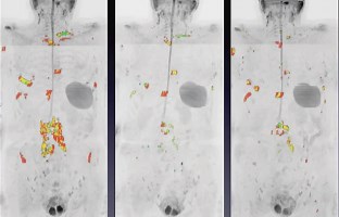 Whole-body magnetic resonance imaging: technique, guidelines and key applications - ecancer