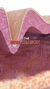 10K reactions · 647 shares | Tired of feeling like nothing is helping fix crepey skin? Harvard dermatologist Dr. J explains how to use moisturizing properly to help achieve the youthful and glowing skin. | Miami MD | Facebook