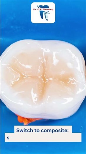 Why You Should Replace Silver Fillings | Modern Dental Clinic #moderndentalclinic #dentalcare