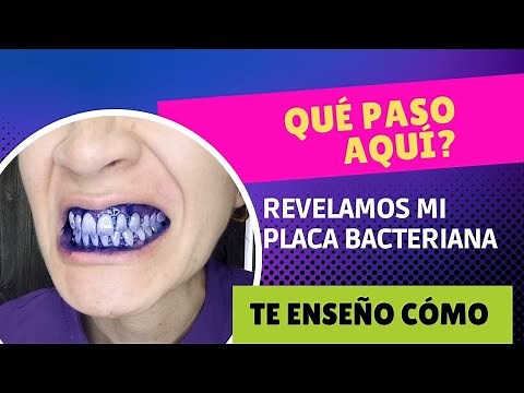 Te ENSEÑO a usar el REVELADOR de PLACA bacteriana