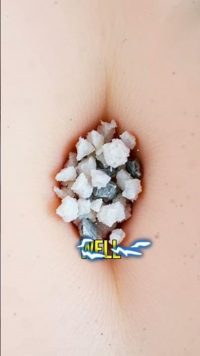 The Mystery of Belly Button Lint Explained! 😱