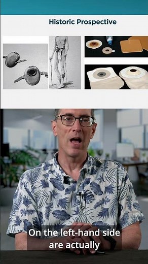 Understanding Stomas: What Every Clinician Should Know