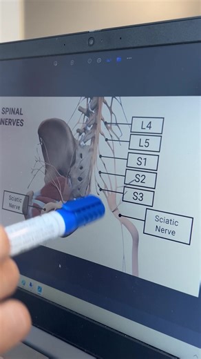 Treat sciatica pain with QI Spine Clinic and get effective relief: • 30+ conditions treated • Treatment without surgery • 92% success rate | QI Spine | Facebook